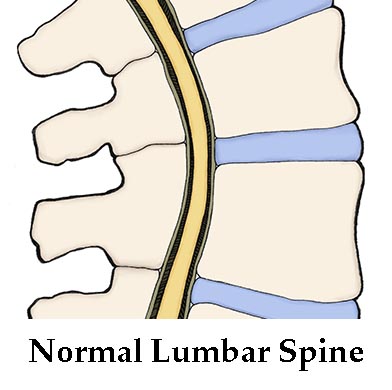 normal-lumbar-spine 390x390